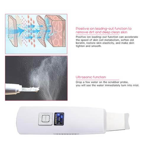 Portable Ultrasonic Skin Scrubber – Electric Blackhead Remover & Facial Cleansing Tool