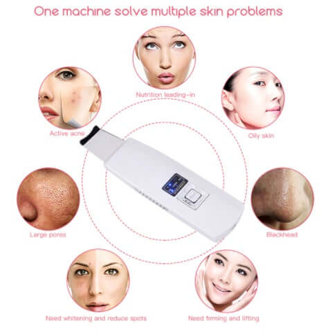 Rechargeable Facial Skin Scrubber – Ultrasonic Deep Pore Cleansing & Exfoliating Device