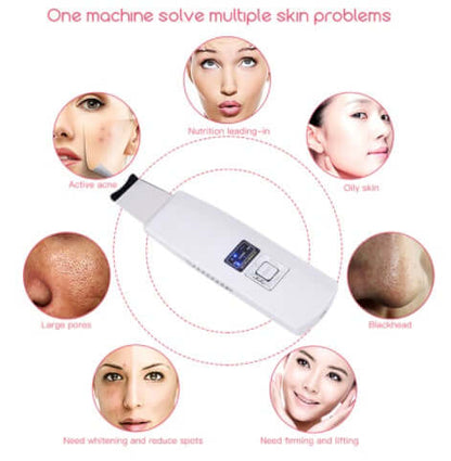 Rechargeable Facial Skin Scrubber – Ultrasonic Deep Pore Cleansing & Exfoliating Device