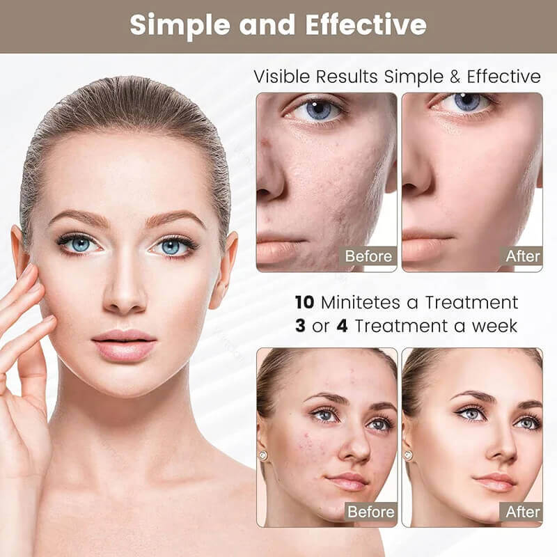 Rechargeable LED Face Mask – Advanced Light Therapy for Healthy-Looking Skin