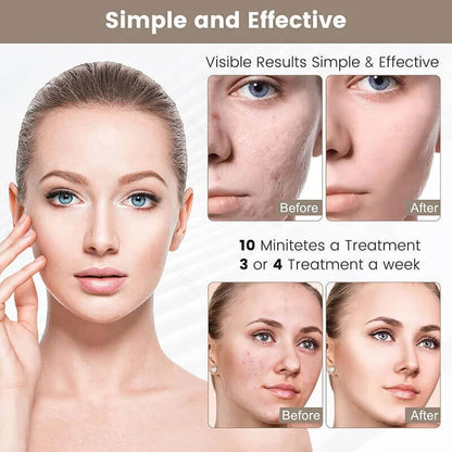 Rechargeable LED Face Mask – Advanced Light Therapy for Healthy-Looking Skin
