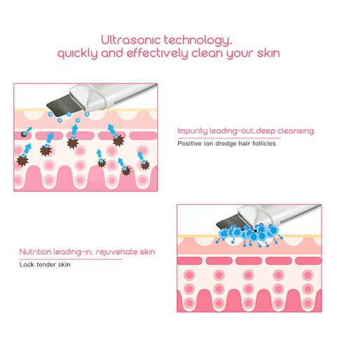 Electric Ultrasonic Skin Spatula – Facial Pore Cleaner & Blackhead Removal Device
